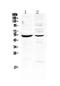 Matrix Metallopeptidase 16 antibody, PA5-79680, Invitrogen Antibodies, Western Blot image 