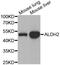 Aldehyde Dehydrogenase 2 Family Member antibody, MBS126262, MyBioSource, Western Blot image 