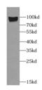 Solute Carrier Family 9 Member A8 antibody, FNab05724, FineTest, Western Blot image 
