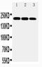 ATP Binding Cassette Subfamily A Member 1 antibody, PA1843, Boster Biological Technology, Western Blot image 