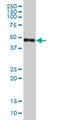 Carboxypeptidase Vitellogenic Like antibody, LS-B4528, Lifespan Biosciences, Western Blot image 