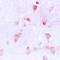 Complement C1q Binding Protein antibody, orb213622, Biorbyt, Immunohistochemistry paraffin image 
