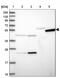 Tigger Transposable Element Derived 6 antibody, NBP1-92508, Novus Biologicals, Western Blot image 