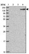 Complement Factor H antibody, NBP2-38695, Novus Biologicals, Western Blot image 