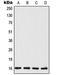 TSC22 Domain Family Member 1 antibody, LS-C353108, Lifespan Biosciences, Western Blot image 