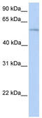 Phospholipase D Family Member 3 antibody, TA336040, Origene, Western Blot image 