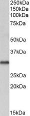 Voltage Dependent Anion Channel 2 antibody, 46-569, ProSci, Enzyme Linked Immunosorbent Assay image 