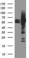Tyrosine Hydroxylase antibody, TA506540BM, Origene, Western Blot image 