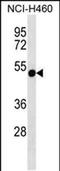 Radial Spoke Head 14 Homolog antibody, PA5-48540, Invitrogen Antibodies, Western Blot image 