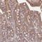 Guanylate Kinase 1 antibody, NBP2-14078, Novus Biologicals, Immunohistochemistry paraffin image 