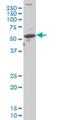 Aristaless Related Homeobox antibody, H00170302-M08, Novus Biologicals, Western Blot image 