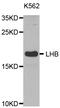 Luteinizing Hormone Beta Polypeptide antibody, LS-C332322, Lifespan Biosciences, Western Blot image 