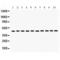 Flotillin 2 antibody, LS-C407836, Lifespan Biosciences, Western Blot image 