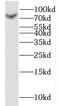 Kelch Like Family Member 4 antibody, FNab04628, FineTest, Western Blot image 