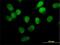 Serine/Threonine Kinase 33 antibody, H00065975-M02, Novus Biologicals, Immunocytochemistry image 