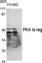 Protein Kinase CAMP-Dependent Type I Regulatory Subunit Alpha antibody, A00699-2, Boster Biological Technology, Western Blot image 