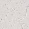 Stabilin 2 antibody, HPA026871, Atlas Antibodies, Immunohistochemistry paraffin image 