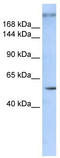 Zinc Finger Protein 407 antibody, TA331885, Origene, Western Blot image 