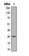 ELOVL Fatty Acid Elongase 5 antibody, orb393274, Biorbyt, Western Blot image 