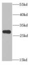 Acidic Nuclear Phosphoprotein 32 Family Member A antibody, FNab00445, FineTest, Western Blot image 