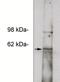Notum, Palmitoleoyl-Protein Carboxylesterase antibody, NBP2-66631, Novus Biologicals, Western Blot image 