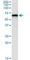 P21 (RAC1) Activated Kinase 1 antibody, H00005058-M02, Novus Biologicals, Immunoprecipitation image 