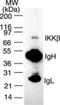 Inhibitor Of Nuclear Factor Kappa B Kinase Subunit Beta antibody, NB100-55780, Novus Biologicals, Western Blot image 