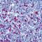 Immunoglobulin Heavy Constant Gamma 1 (G1m Marker) antibody, ab2410, Abcam, Immunohistochemistry paraffin image 