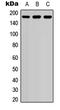 Eukaryotic Translation Initiation Factor 4 Gamma 1 antibody, LS-C356011, Lifespan Biosciences, Western Blot image 