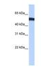 Zinc Finger Protein 486 antibody, NBP1-79462, Novus Biologicals, Western Blot image 