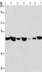 Adipocyte Plasma Membrane Associated Protein antibody, TA350740, Origene, Western Blot image 