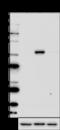 LCK Proto-Oncogene, Src Family Tyrosine Kinase antibody, 601001, BioLegend, Western Blot image 