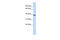 TRNA-YW Synthesizing Protein 5 antibody, 26-588, ProSci, Enzyme Linked Immunosorbent Assay image 