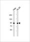 Colony Stimulating Factor 2 Receptor Beta Common Subunit antibody, 62-263, ProSci, Western Blot image 