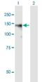 Brevican antibody, H00063827-B01P, Novus Biologicals, Western Blot image 