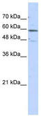 Glutamate Dehydrogenase 2 antibody, TA334426, Origene, Western Blot image 