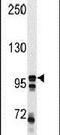 MER Proto-Oncogene, Tyrosine Kinase antibody, PA5-15028, Invitrogen Antibodies, Western Blot image 