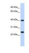 Mesoderm posterior protein 1 antibody, NBP1-80342, Novus Biologicals, Western Blot image 