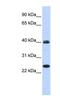 Mesoderm Posterior BHLH Transcription Factor 1 antibody, NBP1-80342, Novus Biologicals, Western Blot image 