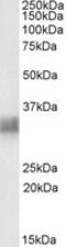 Bone Marrow Stromal Cell Antigen 2 antibody, LS-C112958, Lifespan Biosciences, Western Blot image 