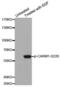 Coactivator Associated Arginine Methyltransferase 1 antibody, MBS128261, MyBioSource, Western Blot image 