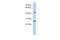 PRAME Family Member 10 antibody, PA5-44175, Invitrogen Antibodies, Western Blot image 