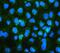 Cytoskeleton Associated Protein 5 antibody, A05324, Boster Biological Technology, Immunofluorescence image 