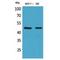 Inhibin Subunit Beta A antibody, LS-C387174, Lifespan Biosciences, Western Blot image 