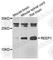 Receptor Accessory Protein 1 antibody, A7832, ABclonal Technology, Western Blot image 