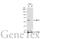 Serine/Threonine Kinase 4 antibody, GTX109294, GeneTex, Western Blot image 