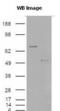 S100 Calcium Binding Protein A9 antibody, PA1-46489, Invitrogen Antibodies, Western Blot image 