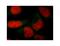 Survival Of Motor Neuron 2, Centromeric antibody, LS-C82216, Lifespan Biosciences, Immunocytochemistry image 
