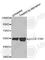 LCK Proto-Oncogene, Src Family Tyrosine Kinase antibody, AP0182, ABclonal Technology, Western Blot image 