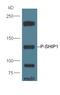 Inositol Polyphosphate-5-Phosphatase D antibody, orb6942, Biorbyt, Western Blot image 